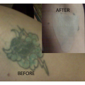 Tattoo Covers:  #1 Product for Tattoo Cover Up